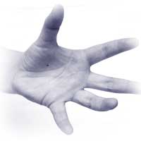Obsessive Compulsive Disorder